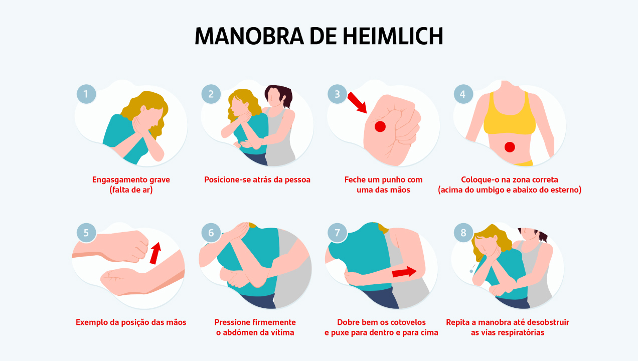 ilustração explicativa de como ministrar a Manobra de Heimlich
